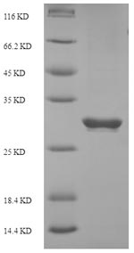 Recombinant Human Programmed Cell Death Protein 1 (PDCD1) Protein (His-SUMO)