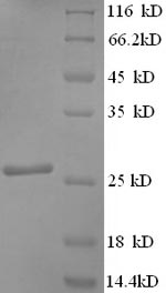 Recombinant Human Synaptosomal-Associated Protein 25 (SNAP25) Protein (His)