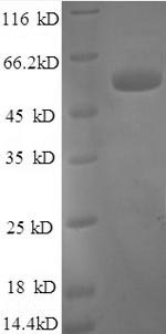 Recombinant Human Tissue factor pathway inhibitor (TFPI), partial