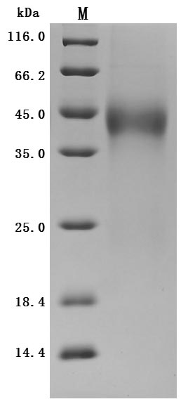 Recombinant Human Tissue factor pathway inhibitor (TFPI), partial (Active)