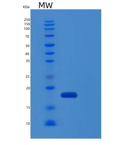 Recombinant Human IL-1RA / IL1RN Protein