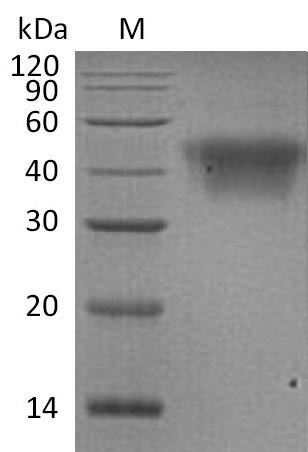 Recombinant Human Low Affinity Immunoglobulin Gamma Fc Region Receptor Iii-A (FCGR3A) Protein (His), Active