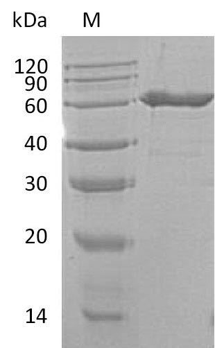 Recombinant Mouse 5'-Nucleotidase (NT5E) Protein (His), Active