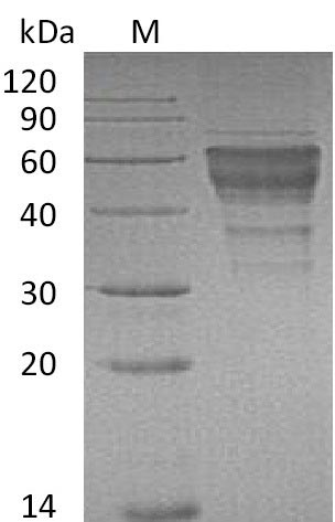 Recombinant Mouse Hepatitis A Virus Cellular Receptor 2 Homolog (HAVCR2) Protein (hFc), Active