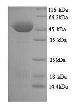 Recombinant Clostridium Botulinum Neurotoxin Type A (BOTA) Protein (His), partial