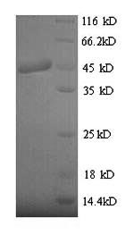 Recombinant Clostridium Botulinum Neurotoxin Type B (BOTB) Protein (His), partial