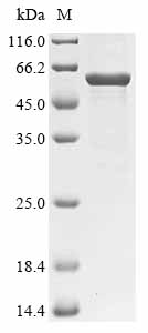 Recombinant Francisella tularensis subsp. tularensis LPS-assembly protein lptD (lptD), partial