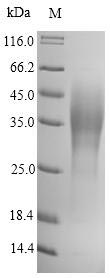 Recombinant Yersinia Pestis F1 Capsule Antigen (CAF1) Protein (His)